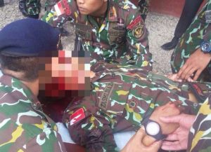 Terkait Tewasnya Perwira Brimob :Mabes Polri Turunkan Tim selidiki Dugaan Bunuh Diri