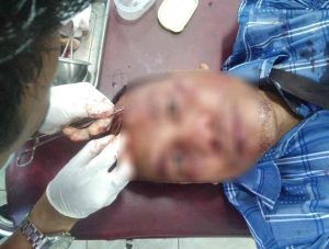 Grebek Bandar Sabu,Kapolsek Palu Utara Dibacok Di kepala