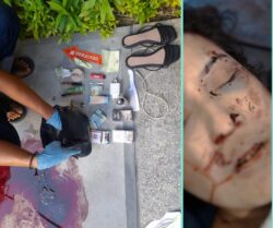 Polisi Enggan Buka Suara Terkait Perkembangan Penyidikan Kematian Tidak Wajar Wanita Dihotel Rama